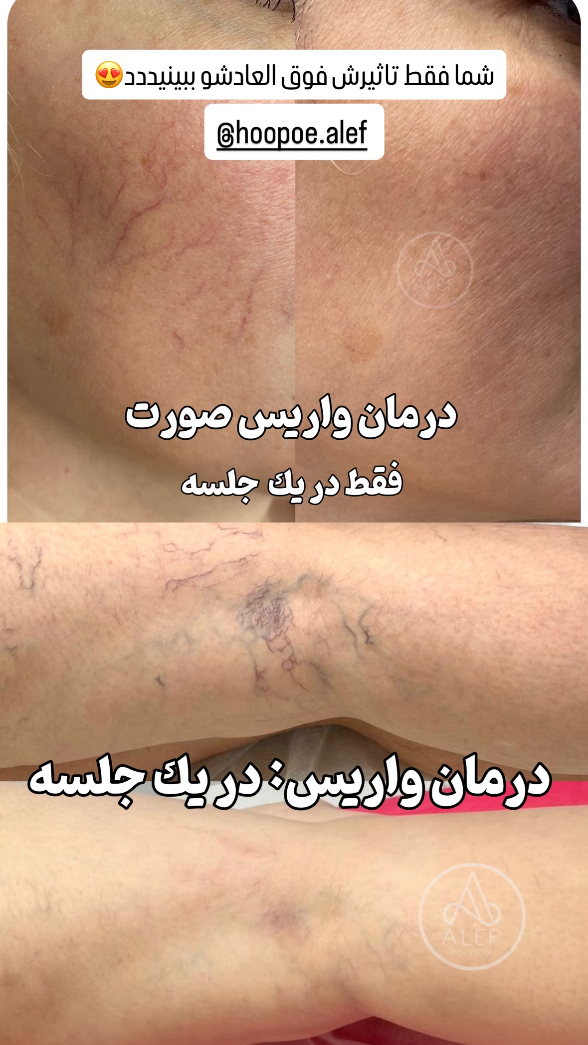 جدید ترین استوری اینستاگرام شیوا نصرتی