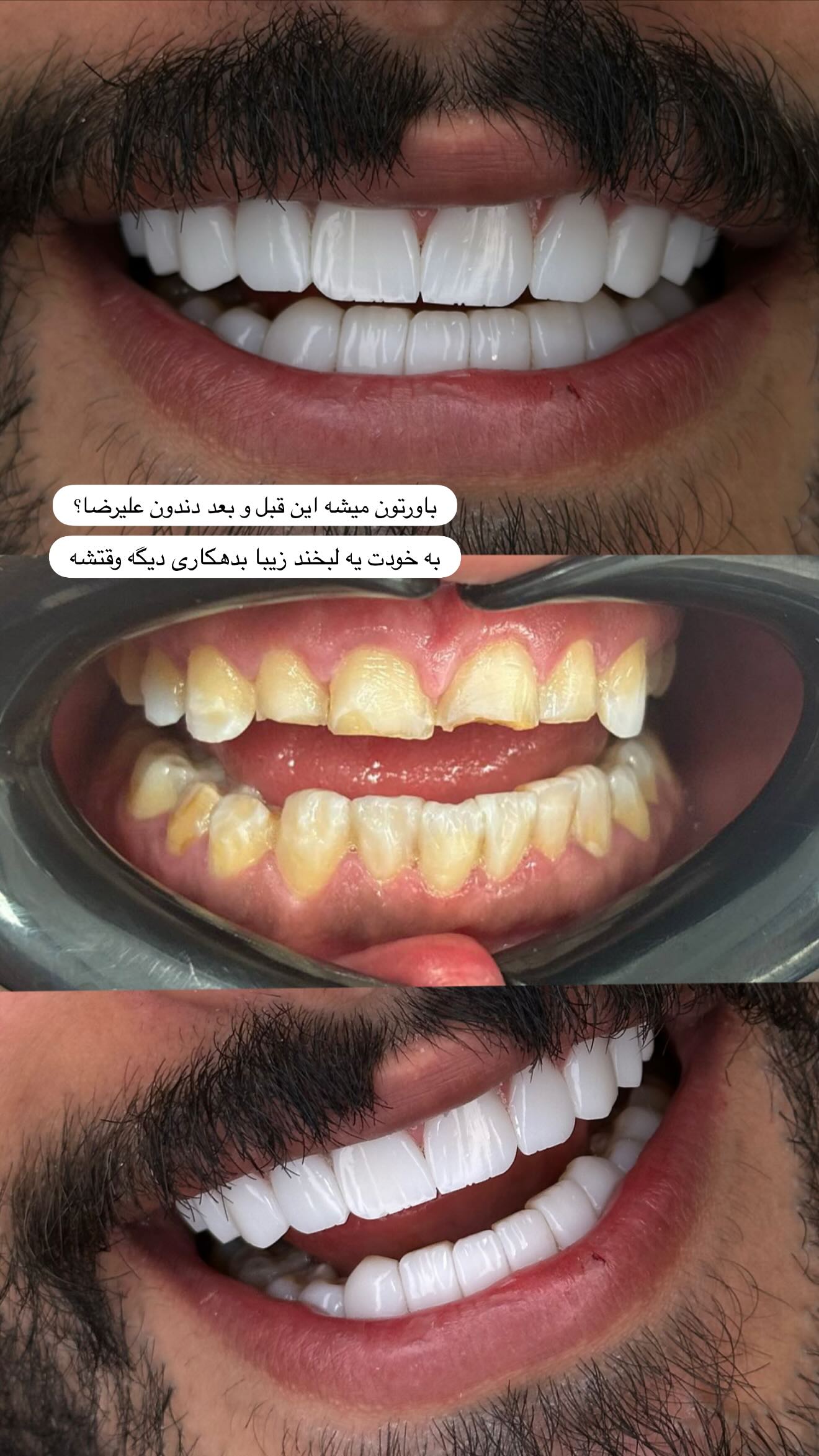  جدید ترین استوری اینستاگرام شکوفه رمضانی