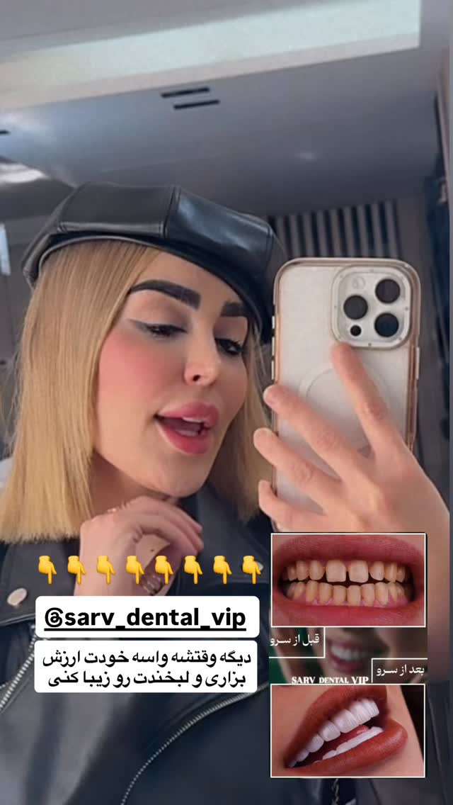  جدید ترین استوری اینستاگرام شکوفه رمضانی