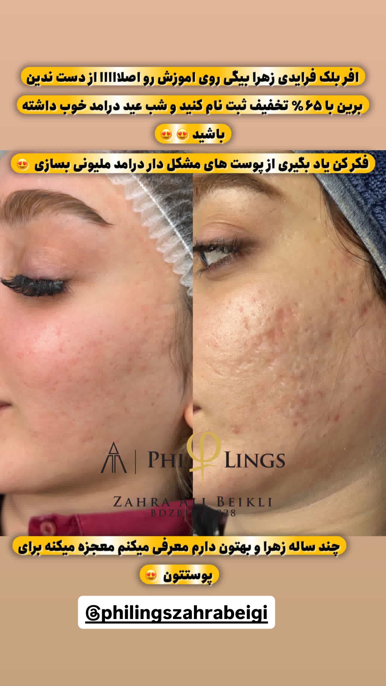  جدید ترین استوری اینستاگرام سیما علیپور