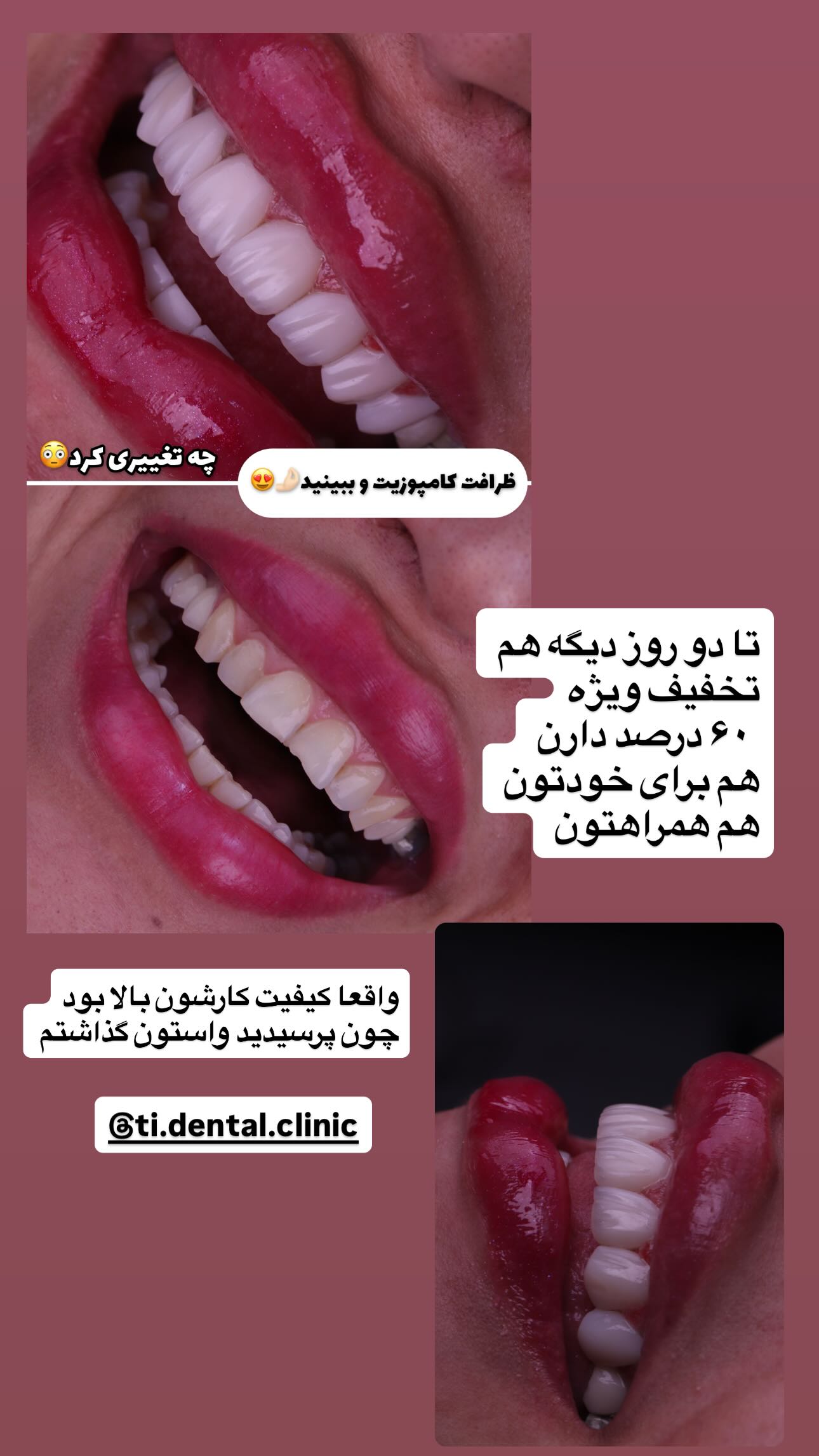  جدید ترین استوری اینستاگرام سیما علیپور