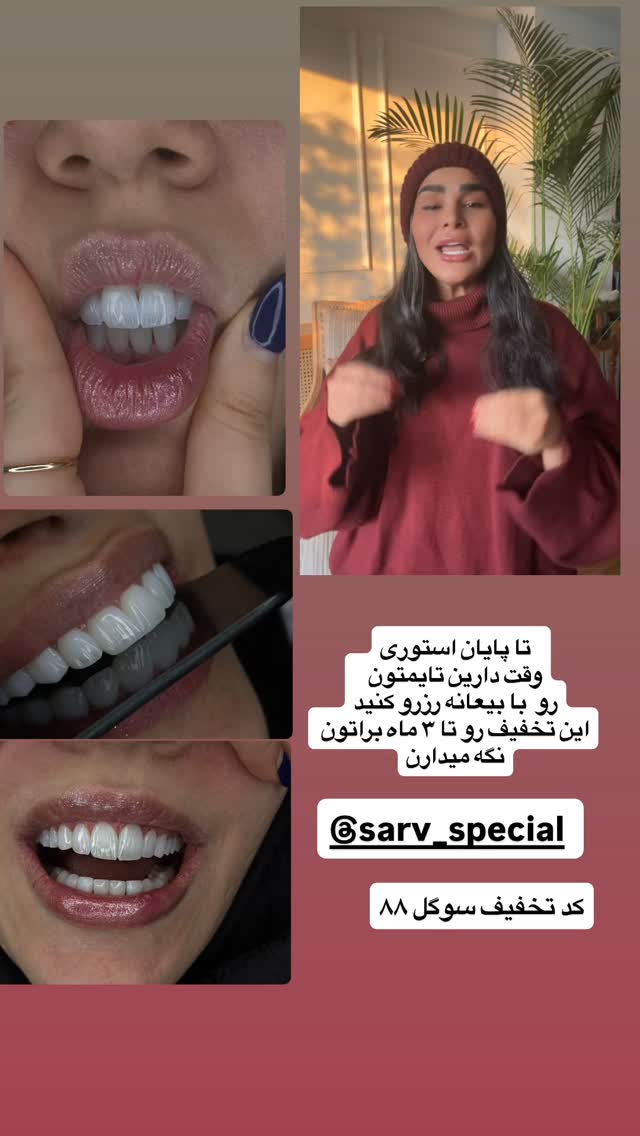  جدید ترین استوری اینستاگرام سوگل میثاقی