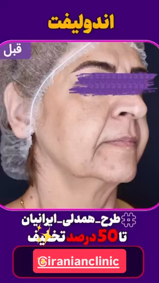  جدید ترین استوری اینستاگرام سید حمید رضا پرهیزگار