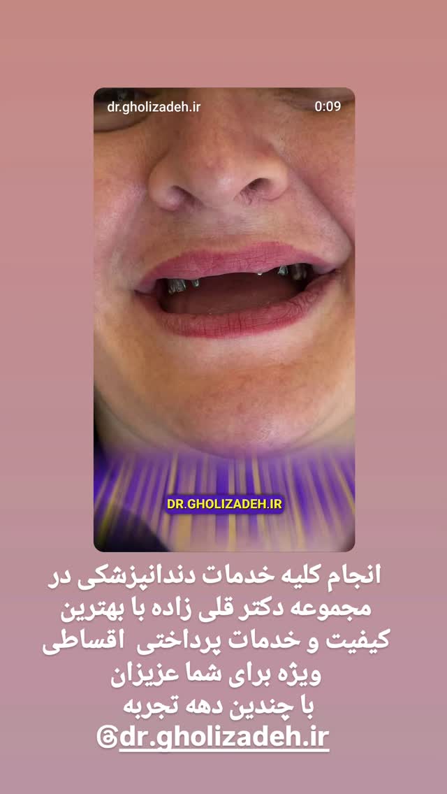 جدید ترین استوری اینستاگرام تبریز وان