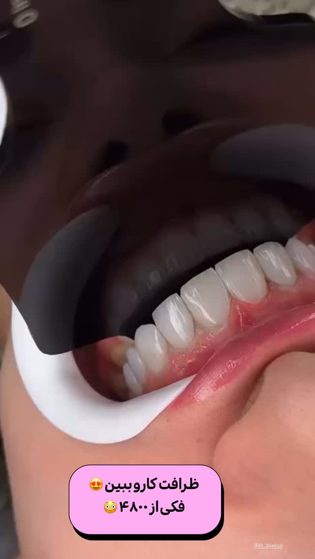  جدید ترین استوری اینستاگرام طاهره پورصابری