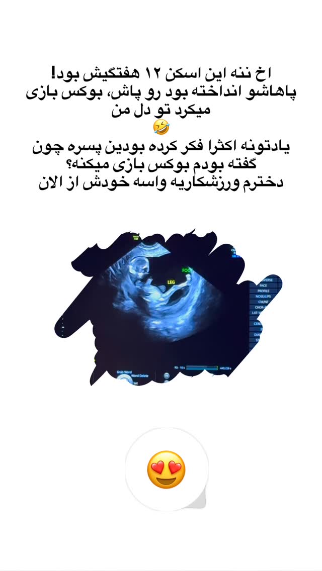  جدید ترین استوری اینستاگرام مریم خسرو انجم