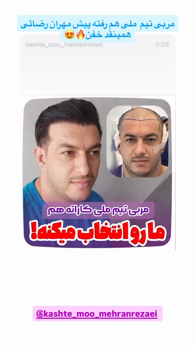  جدید ترین استوری اینستاگرام وحید عطار