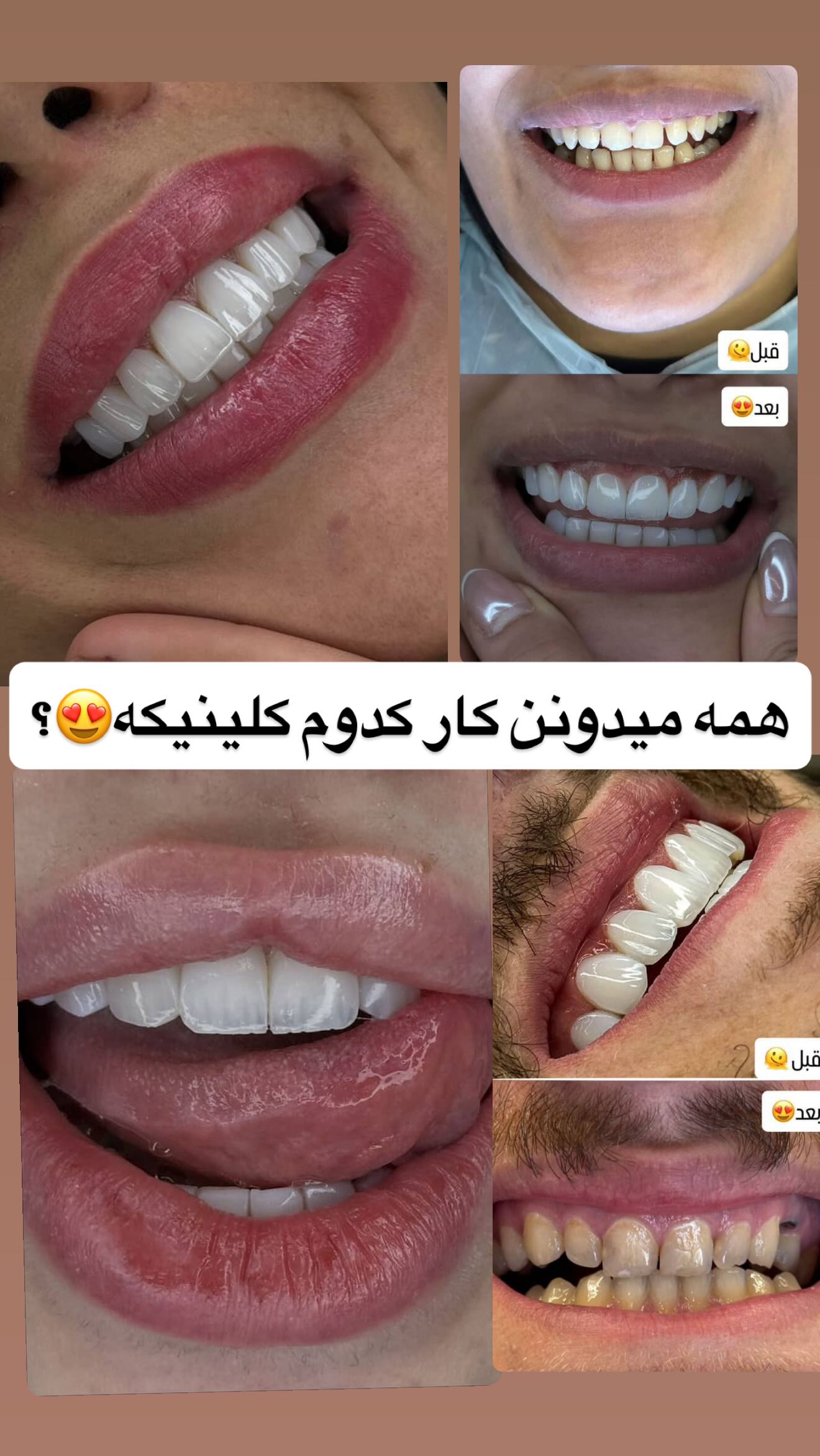  جدید ترین استوری اینستاگرام وحید عطار