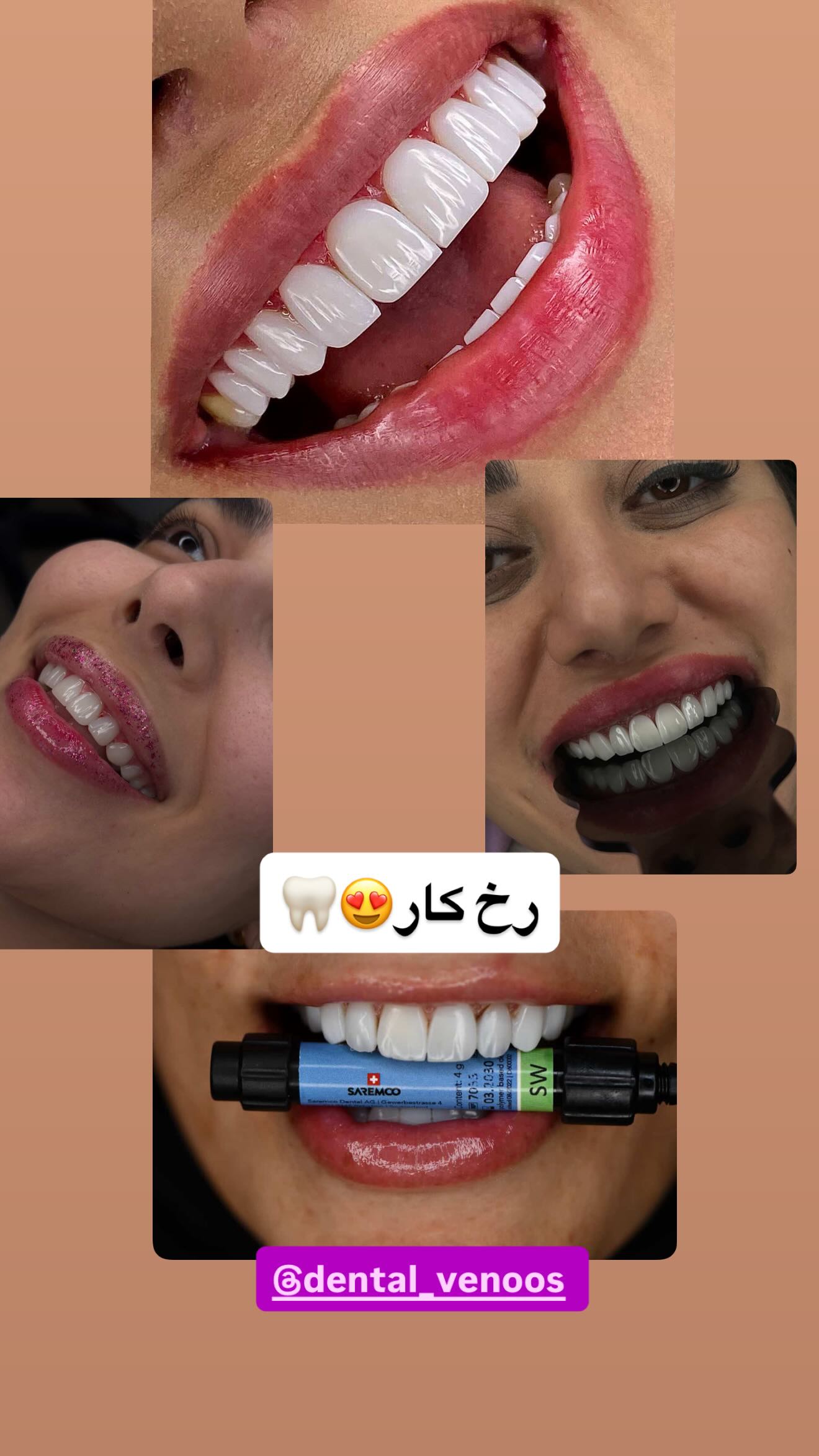  جدید ترین استوری اینستاگرام وحید عطار
