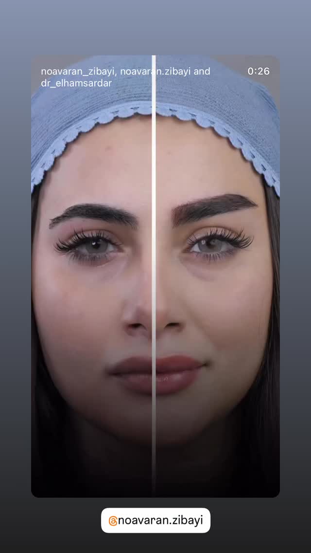  جدید ترین استوری اینستاگرام وحید معصومی