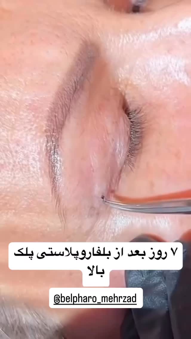  جدید ترین استوری اینستاگرام وحیده علی حسینی