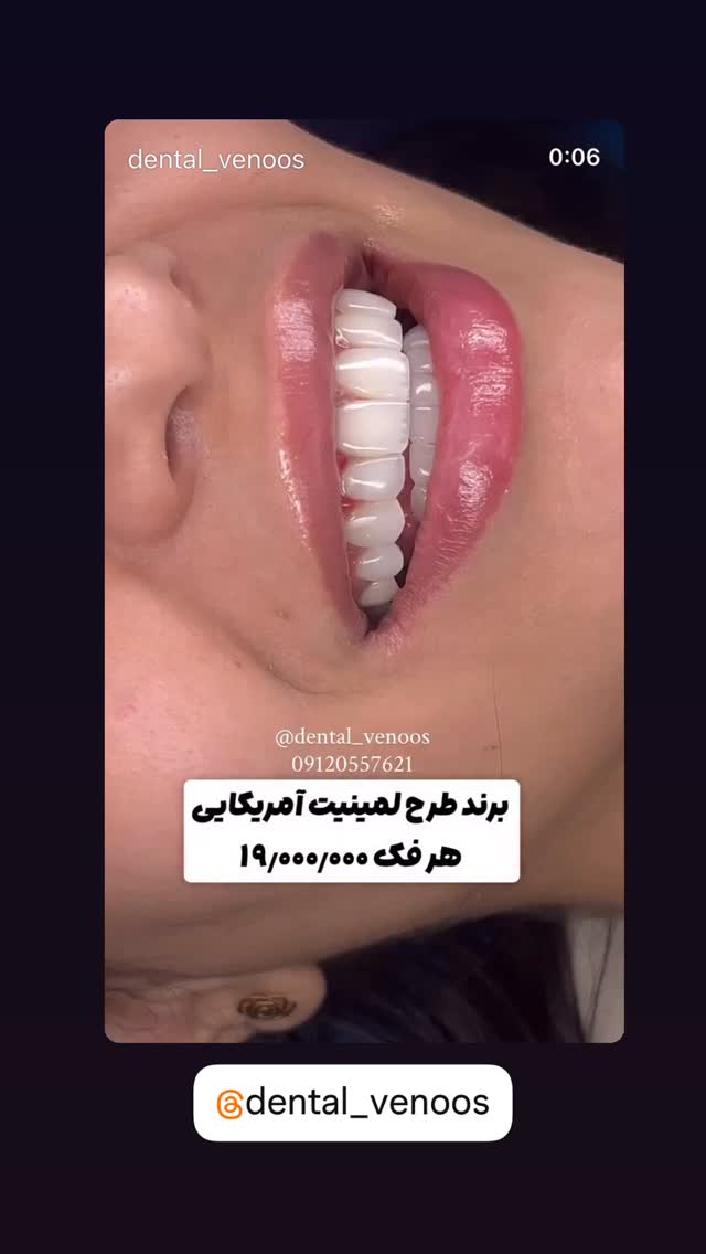 جدید ترین استوری اینستاگرام وحیدرضا صادق پور