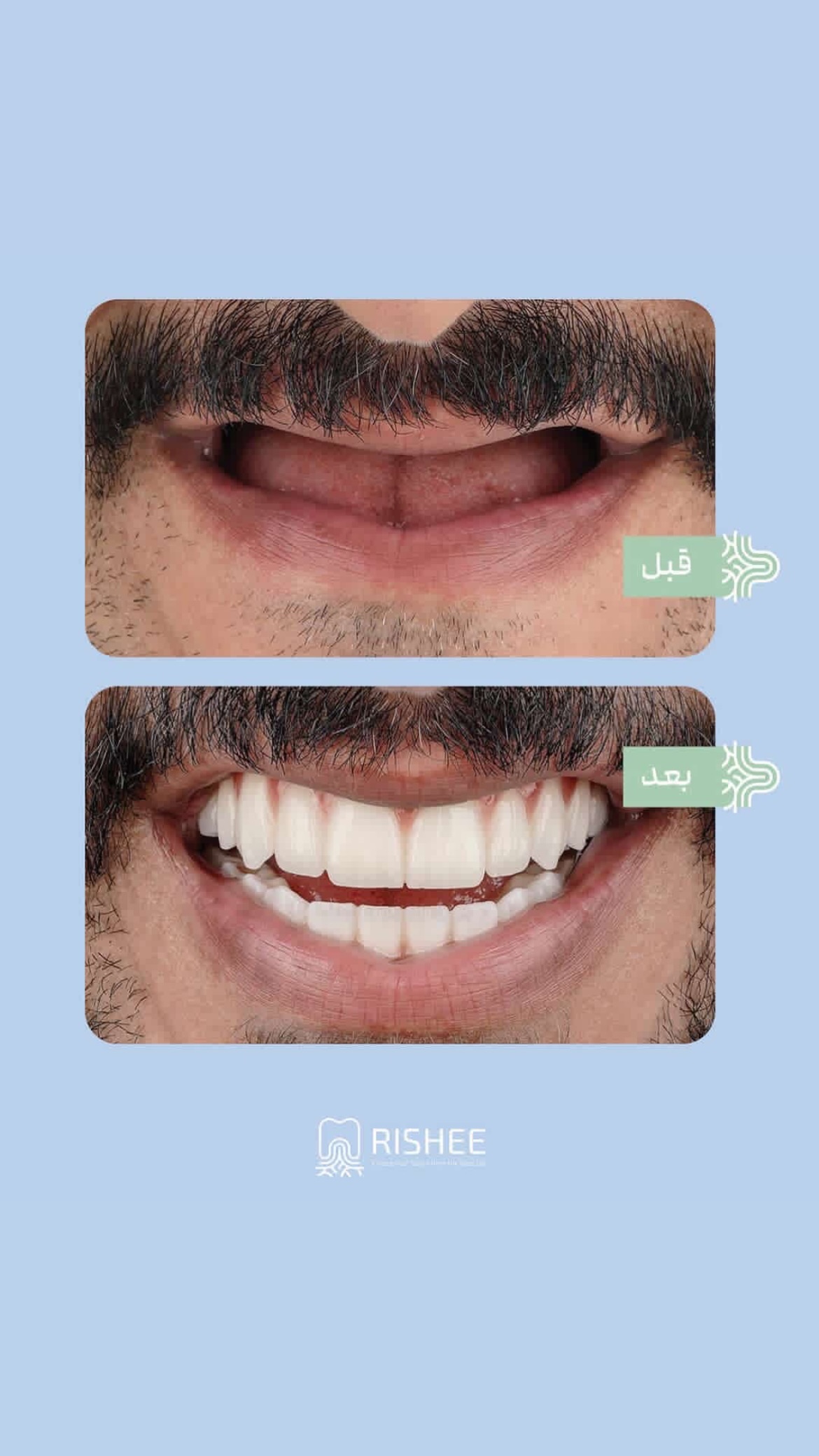  جدید ترین استوری اینستاگرام ویدا کیاروستمی