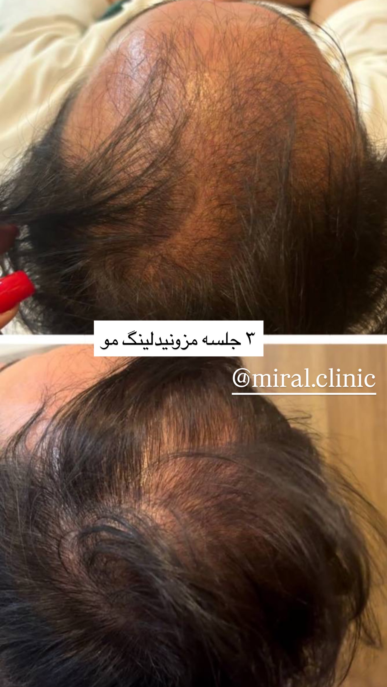  جدید ترین استوری اینستاگرام خانواده ویهان ایهان