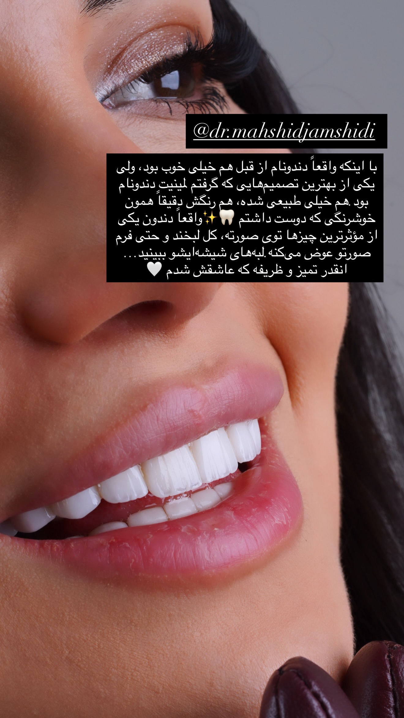  جدید ترین استوری اینستاگرام وینا محمدی