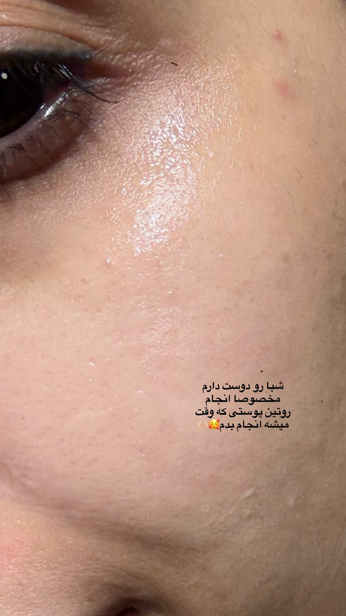  جدید ترین استوری اینستاگرام یهدا