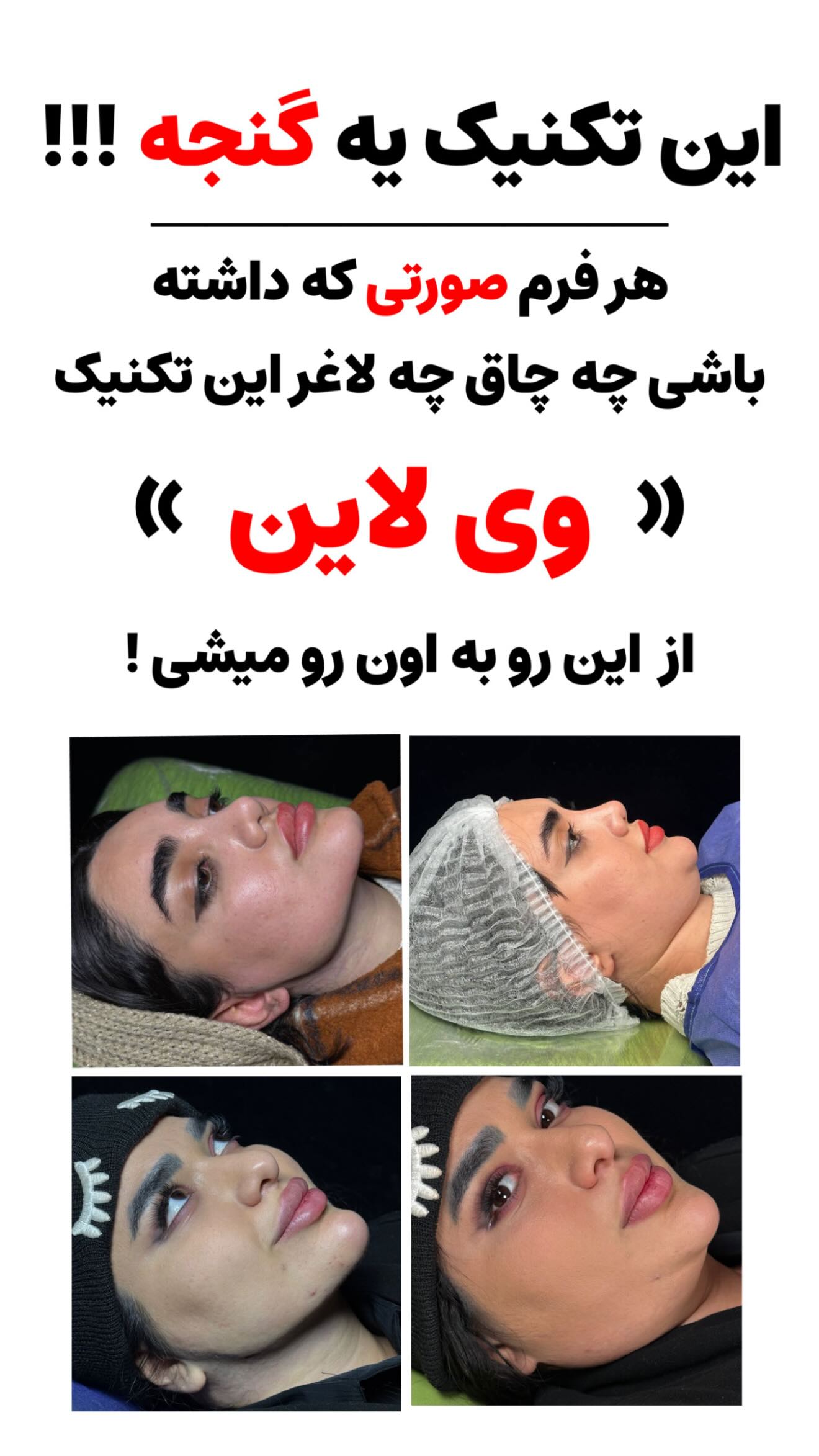 جدید ترین استوری اینستاگرام زهرا سادات یحیی زاده