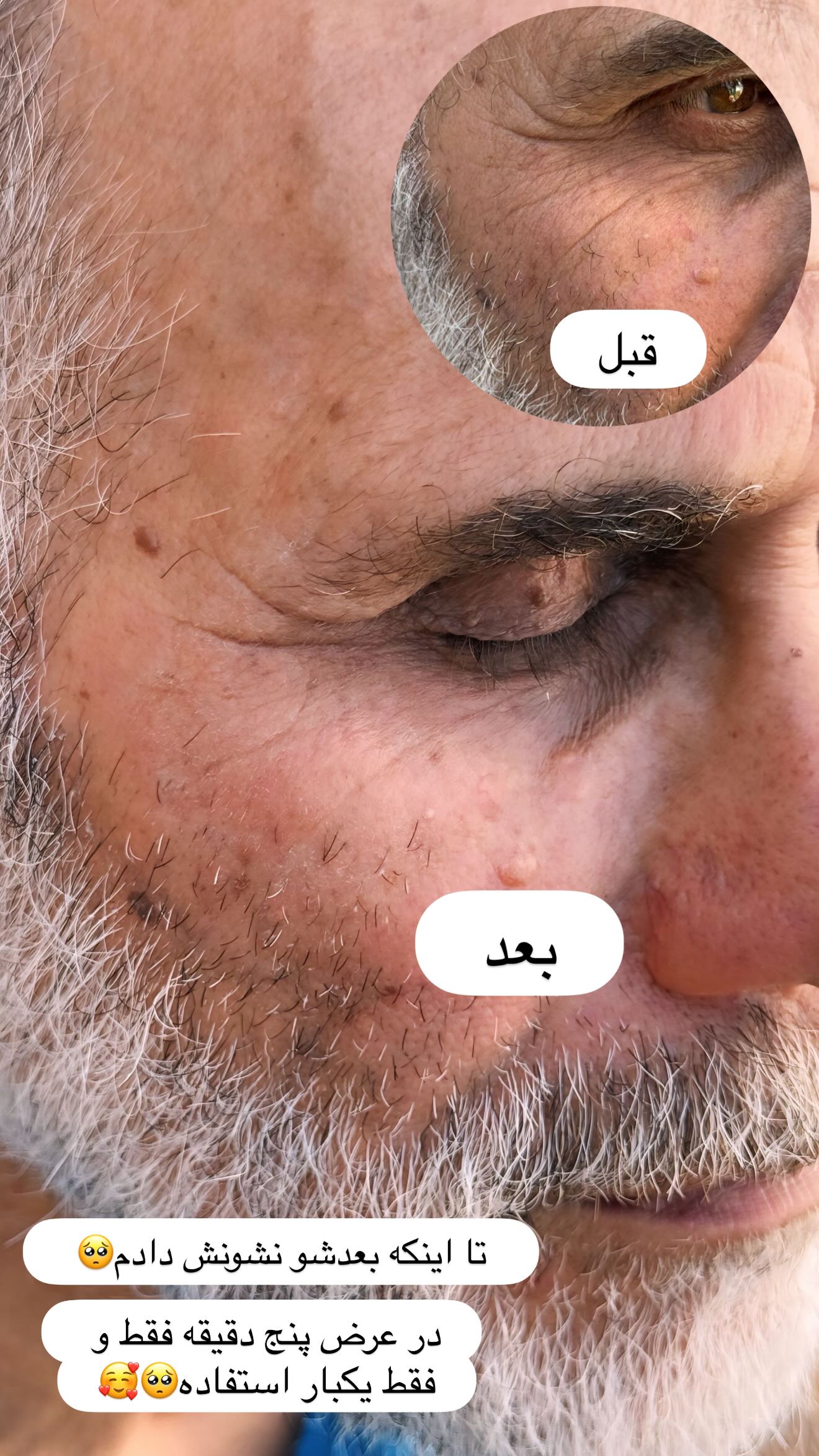  جدید ترین استوری اینستاگرام زهرا سادات یحیی زاده
