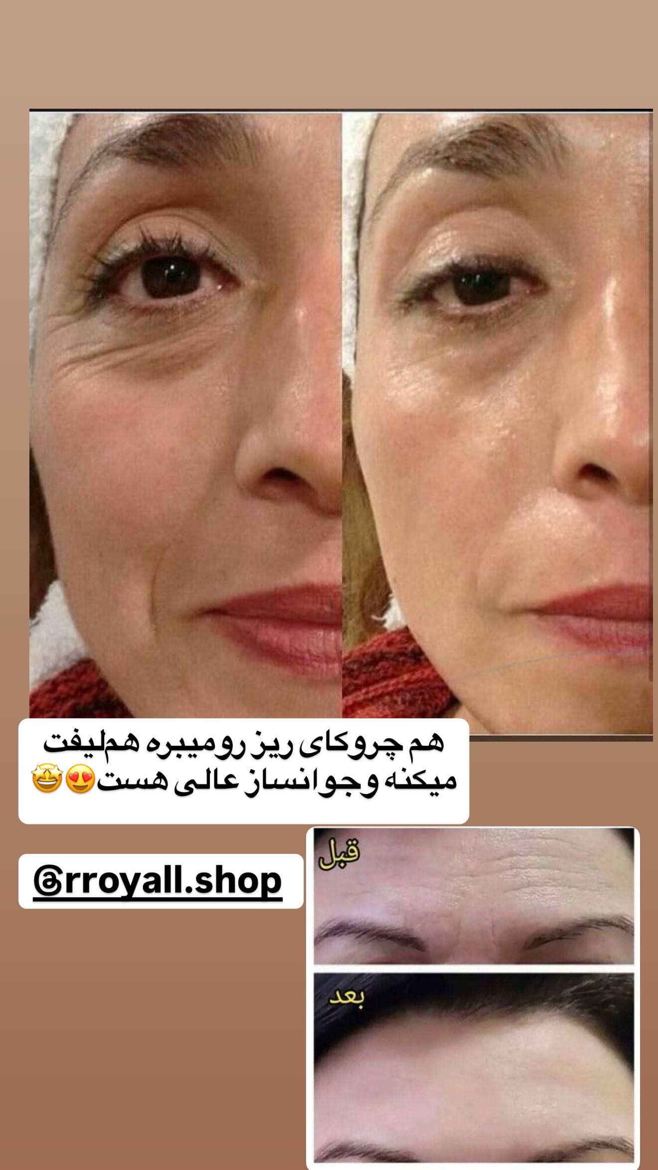  جدید ترین استوری اینستاگرام زهرا سادات یحیی زاده