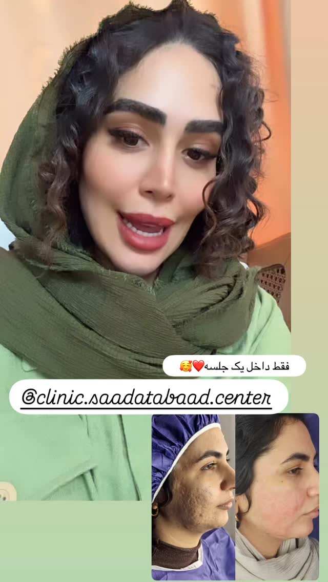  جدید ترین استوری اینستاگرام زهرا سادات یحیی زاده