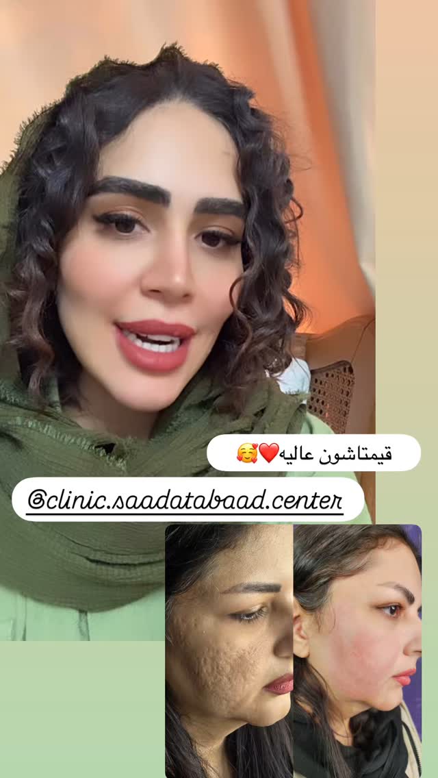  جدید ترین استوری اینستاگرام زهرا سادات یحیی زاده