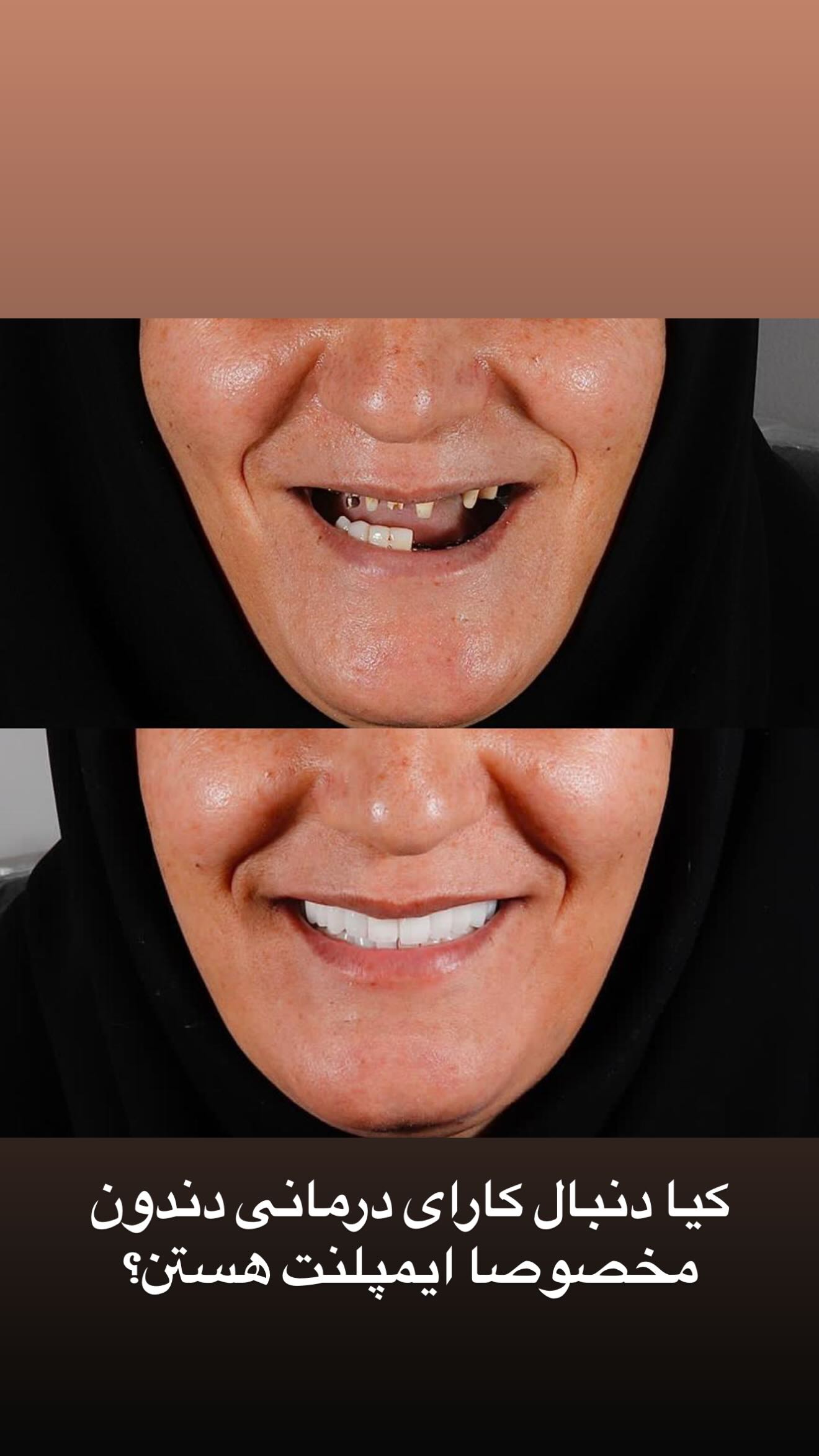  جدید ترین استوری اینستاگرام زهرا سادات یحیی زاده