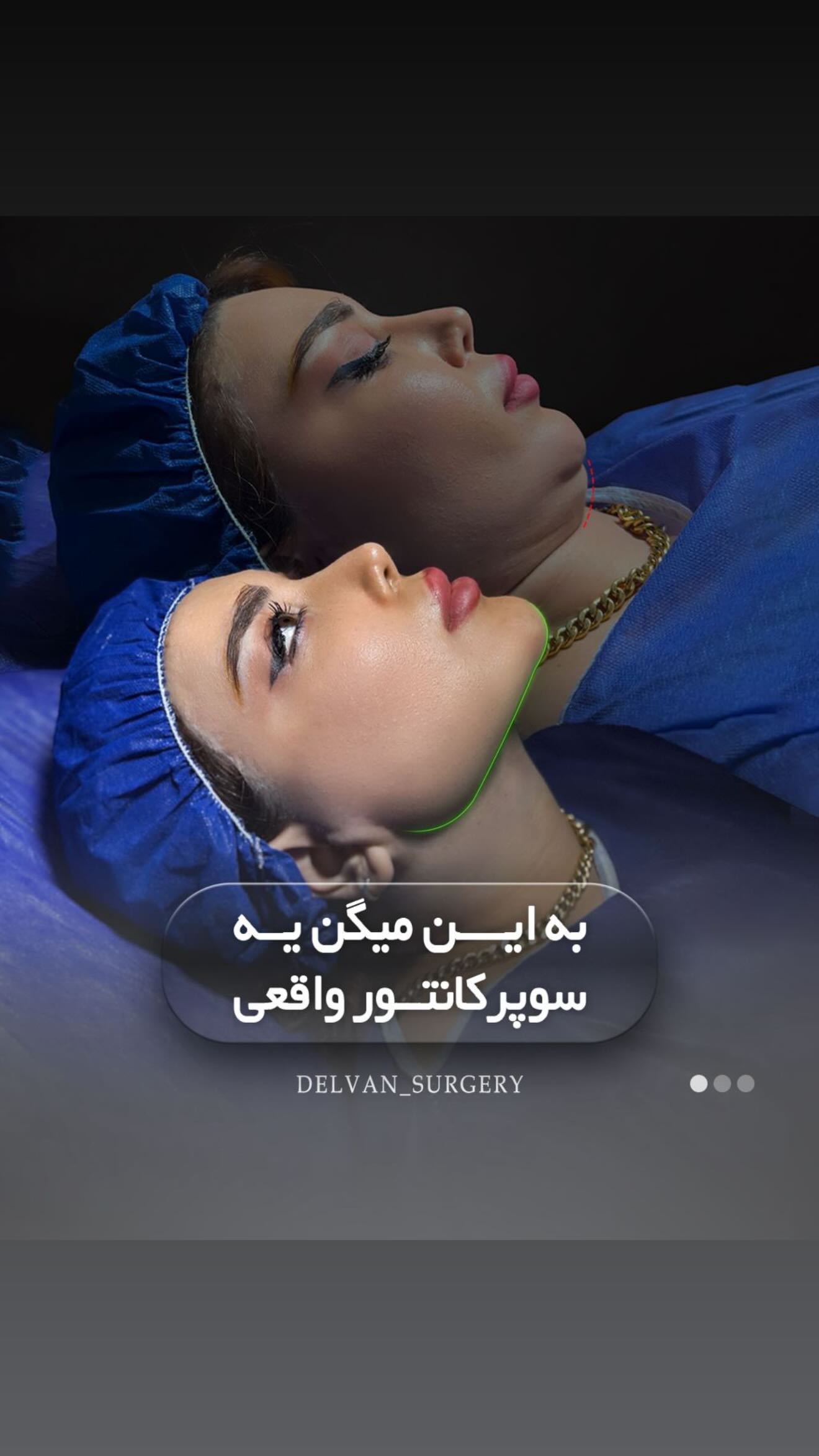  جدید ترین استوری اینستاگرام زهرا سادات یحیی زاده
