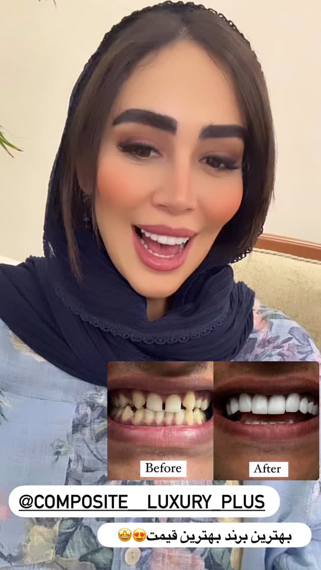  جدید ترین استوری اینستاگرام زهرا سادات یحیی زاده