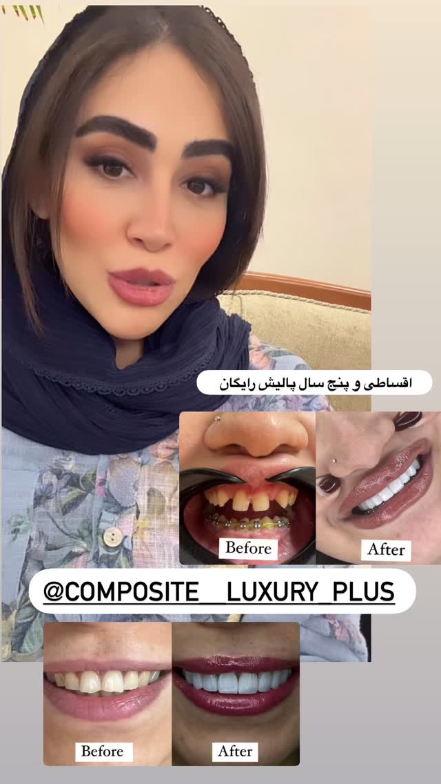  جدید ترین استوری اینستاگرام زهرا سادات یحیی زاده