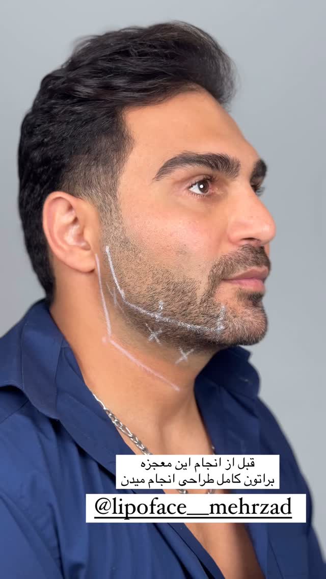  جدید ترین استوری اینستاگرام زهرا سادات یحیی زاده