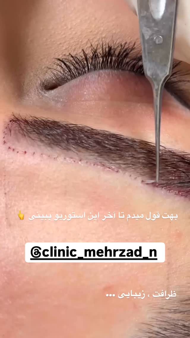  جدید ترین استوری اینستاگرام زهرا سادات یحیی زاده