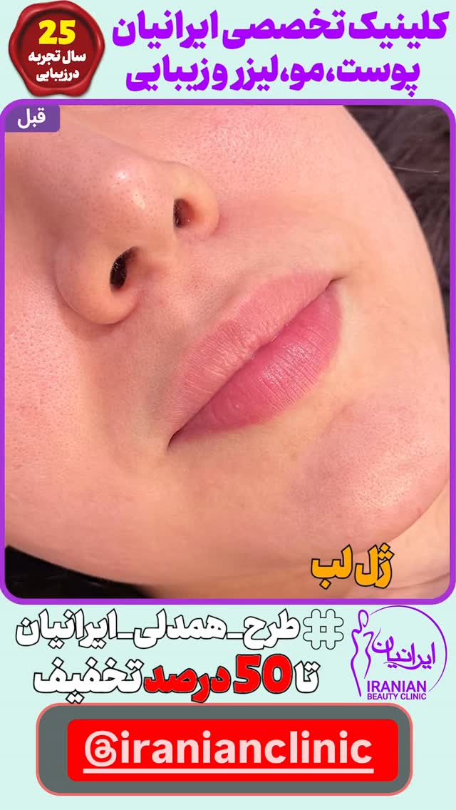  جدید ترین استوری اینستاگرام زهرا سادات یحیی زاده