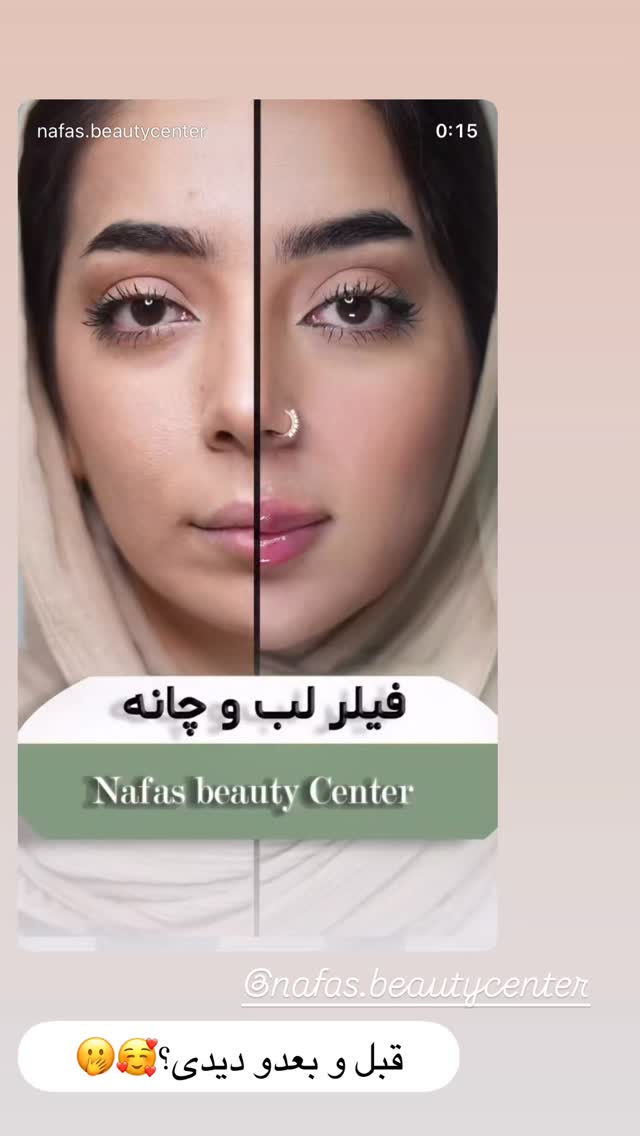  جدید ترین استوری اینستاگرام زهرا سادات یحیی زاده