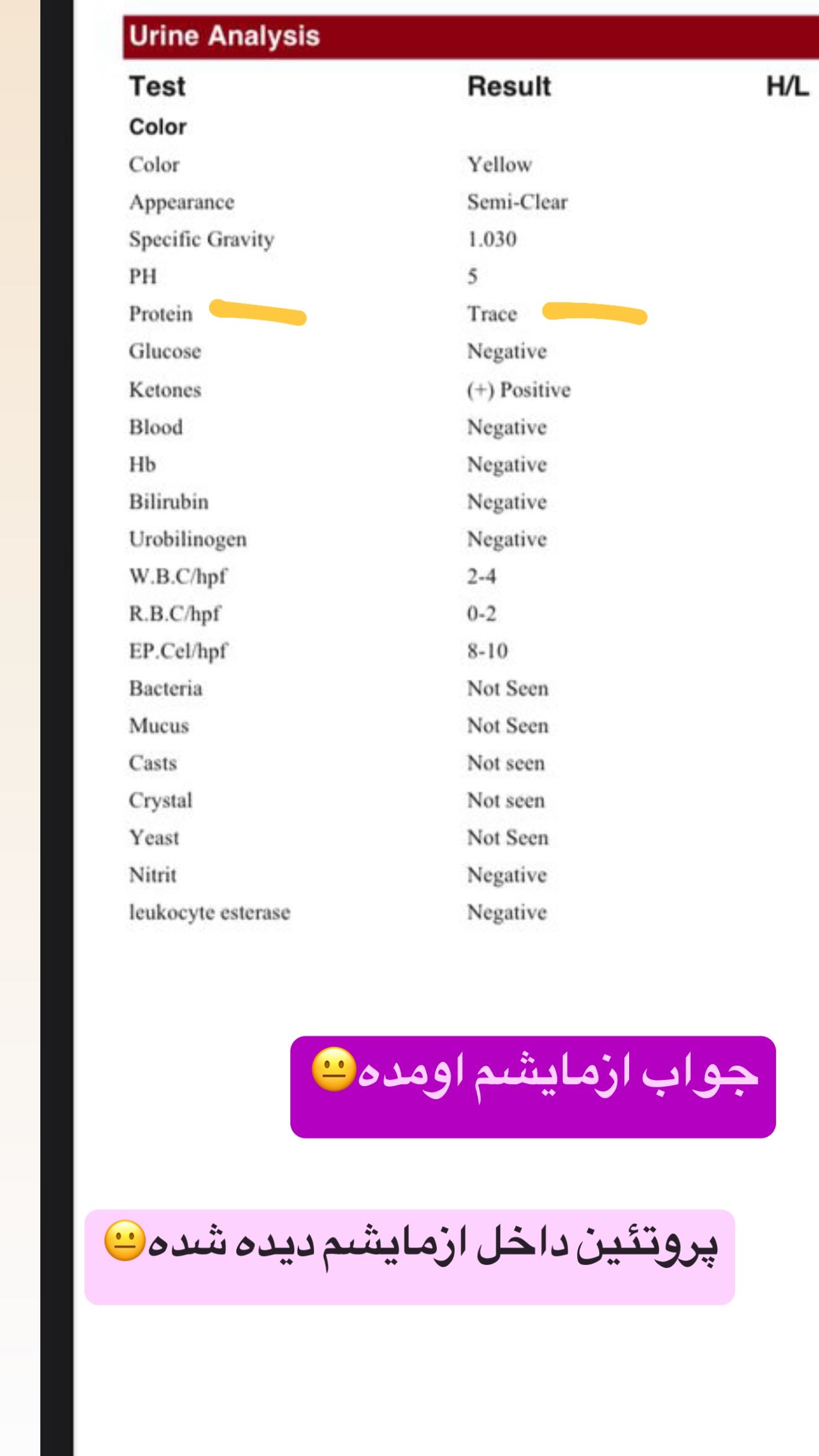 جدید ترین استوری اینستاگرام زهرا سادات یحیی زاده