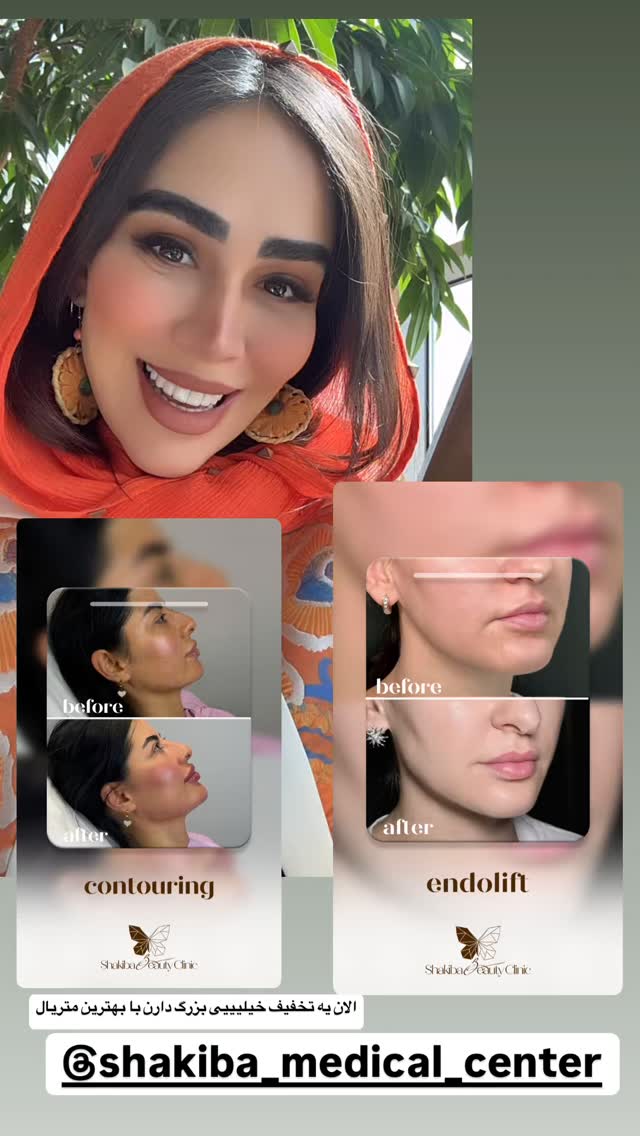  جدید ترین استوری اینستاگرام زهرا سادات یحیی زاده