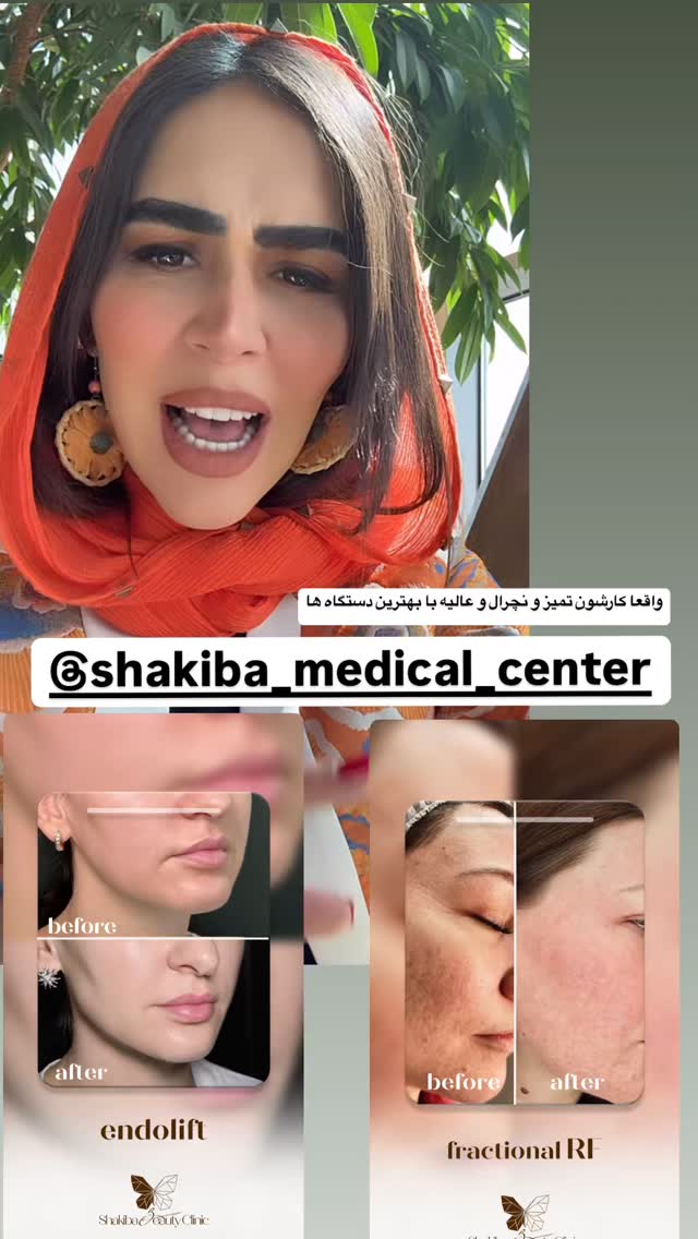  جدید ترین استوری اینستاگرام زهرا سادات یحیی زاده