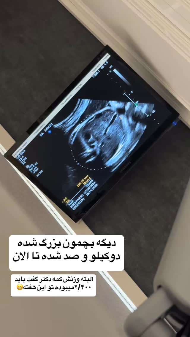  جدید ترین استوری اینستاگرام زهرا سادات یحیی زاده