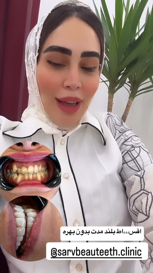  جدید ترین استوری اینستاگرام زهرا سادات یحیی زاده