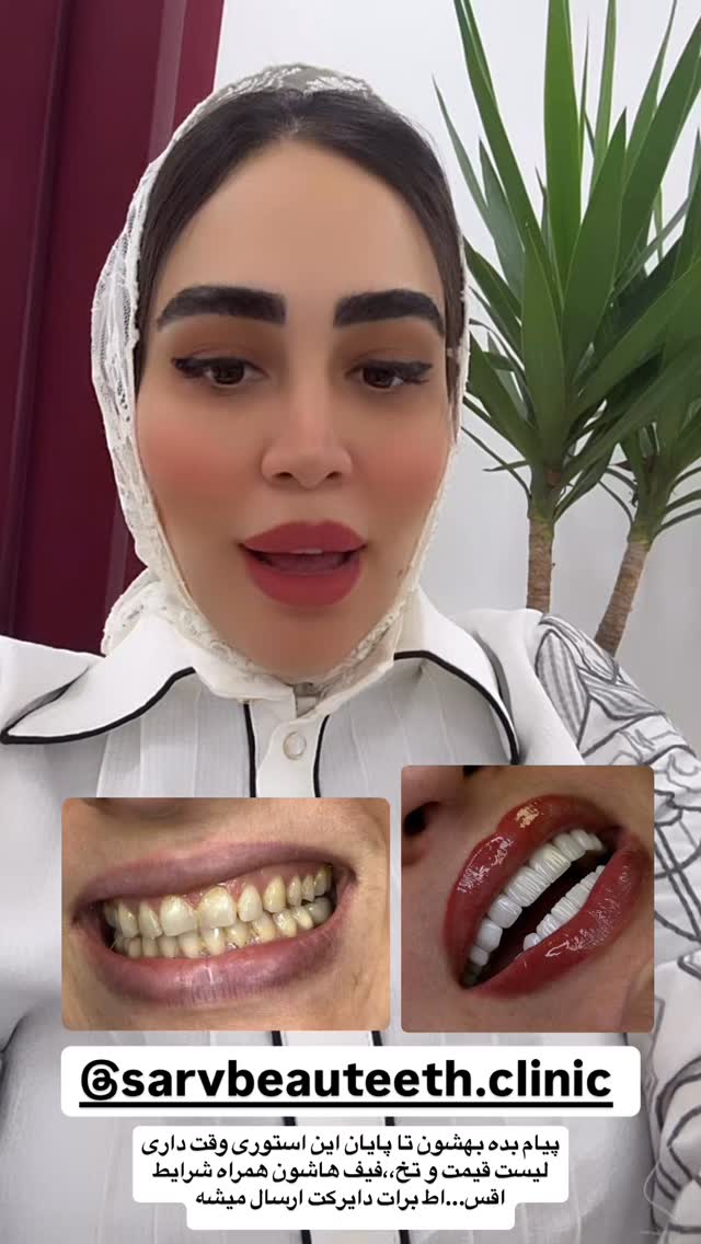  جدید ترین استوری اینستاگرام زهرا سادات یحیی زاده