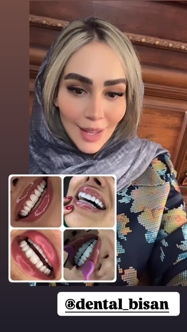  جدید ترین استوری اینستاگرام زهرا سادات یحیی زاده