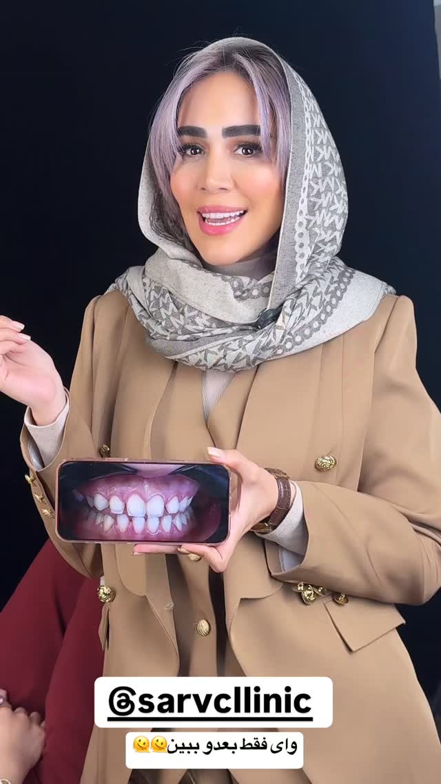  جدید ترین استوری اینستاگرام زهرا سادات یحیی زاده