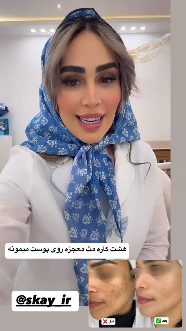  جدید ترین استوری اینستاگرام زهرا سادات یحیی زاده