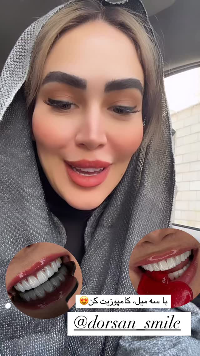  جدید ترین استوری اینستاگرام زهرا سادات یحیی زاده