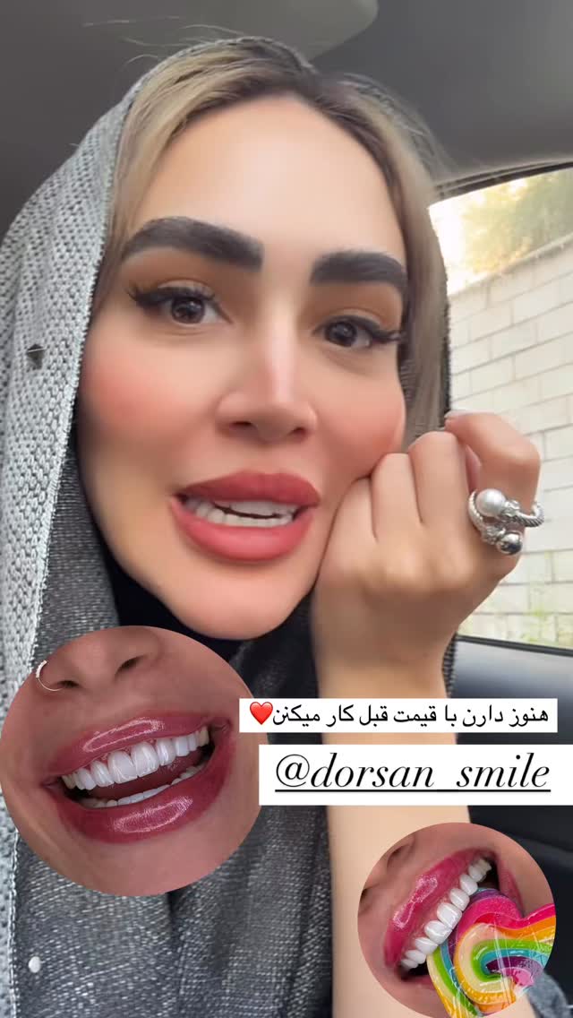  جدید ترین استوری اینستاگرام زهرا سادات یحیی زاده