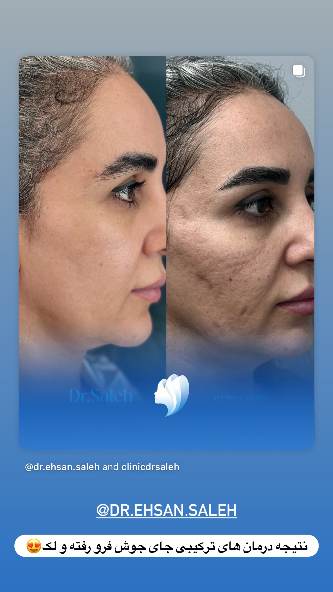  جدید ترین استوری اینستاگرام یاسین حسینی
