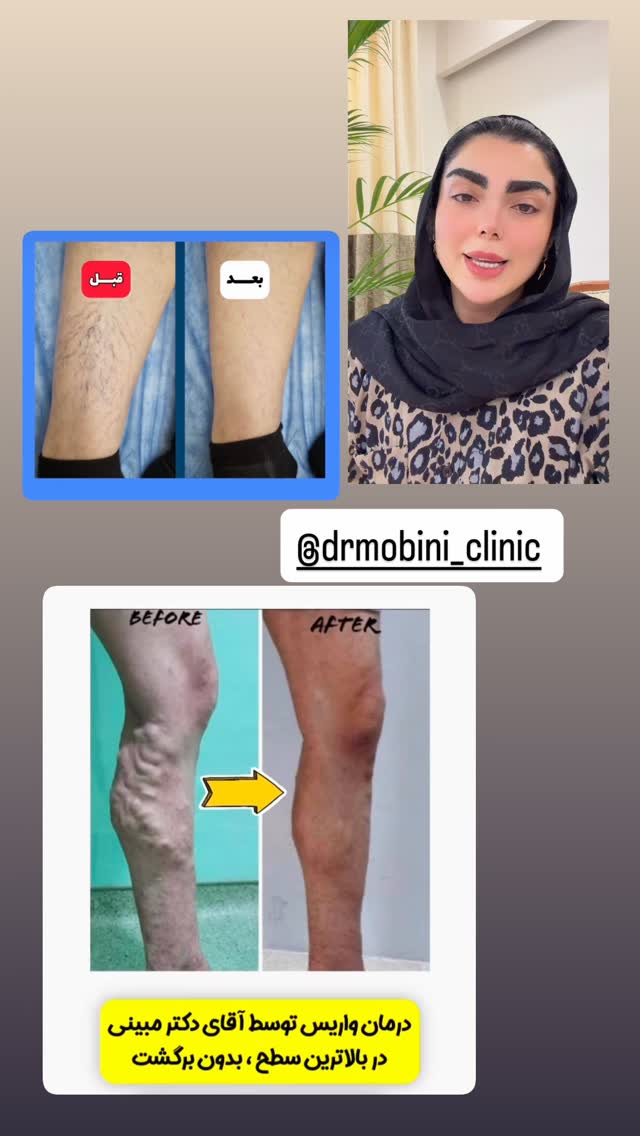  جدید ترین استوری اینستاگرام یگانه رضایی
