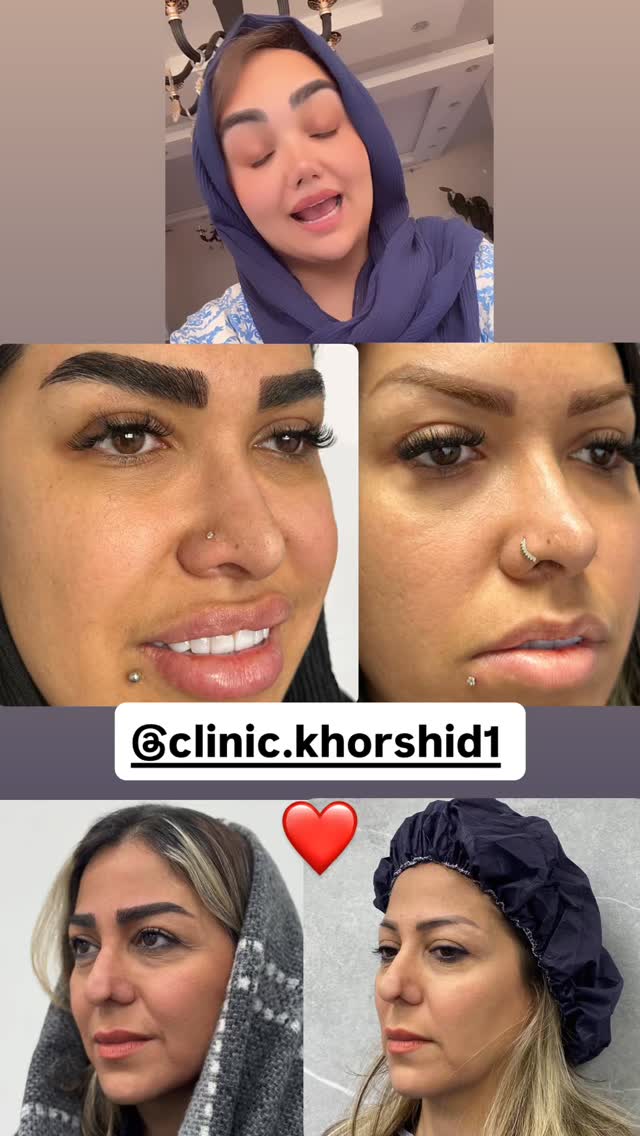  جدید ترین استوری اینستاگرام زهرا تاجیک