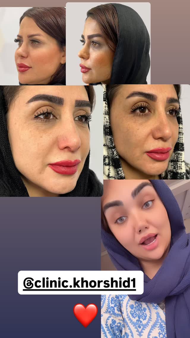  جدید ترین استوری اینستاگرام زهرا تاجیک