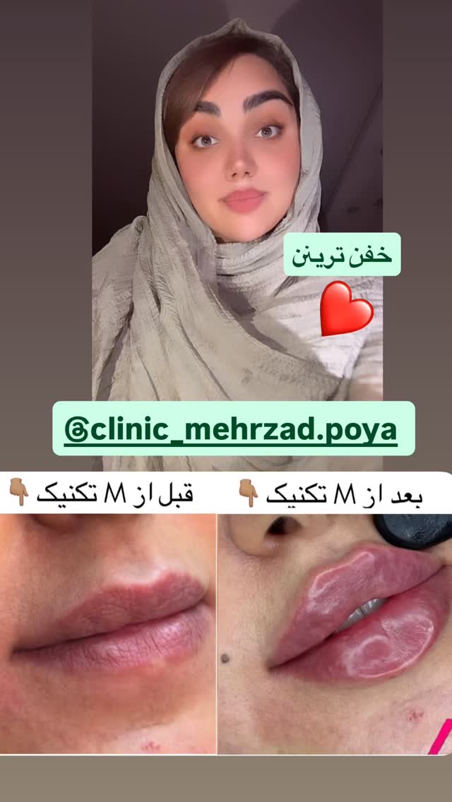  جدید ترین استوری اینستاگرام زهرا تاجیک