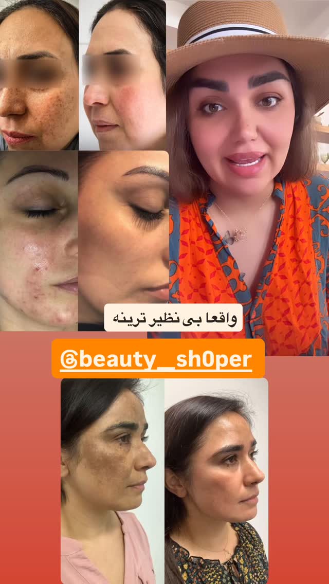  جدید ترین استوری اینستاگرام زهرا تاجیک